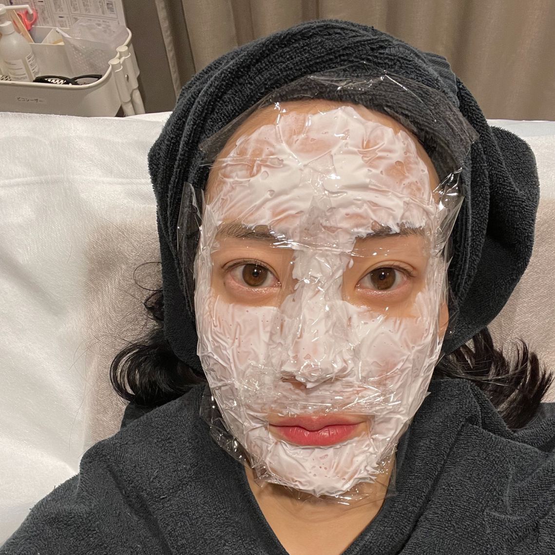 ハイフでもボトックスでもなく、クマ治療？おしゃれPRの美容医療体験記。【大澤祥子のマイナス4歳、美容道。】