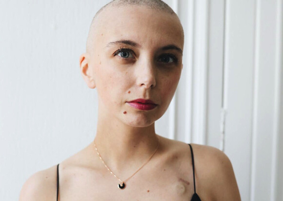 emilie-daudin--je-netais-pas-censee-avoir-un-cancer-du-sein-a-30-ans.jpg