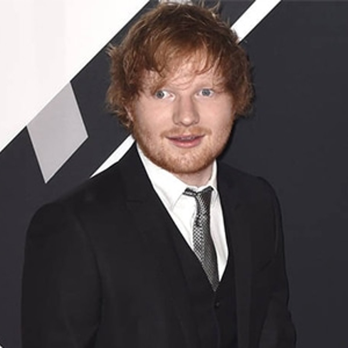 エド・シーラン、顔を切られるアクシデント発生！