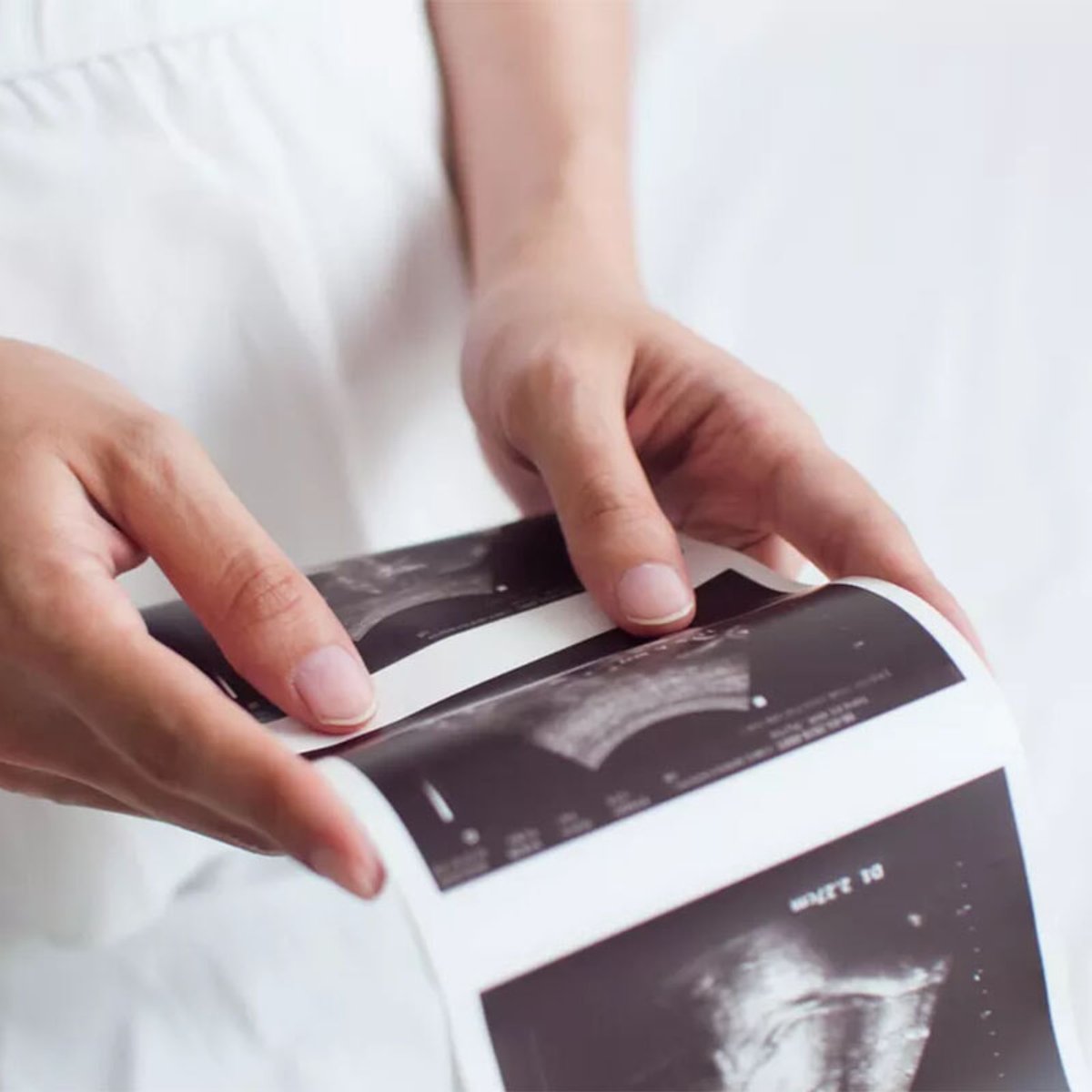 妊娠中に2人目を妊娠：過受胎の驚きの事例とは？