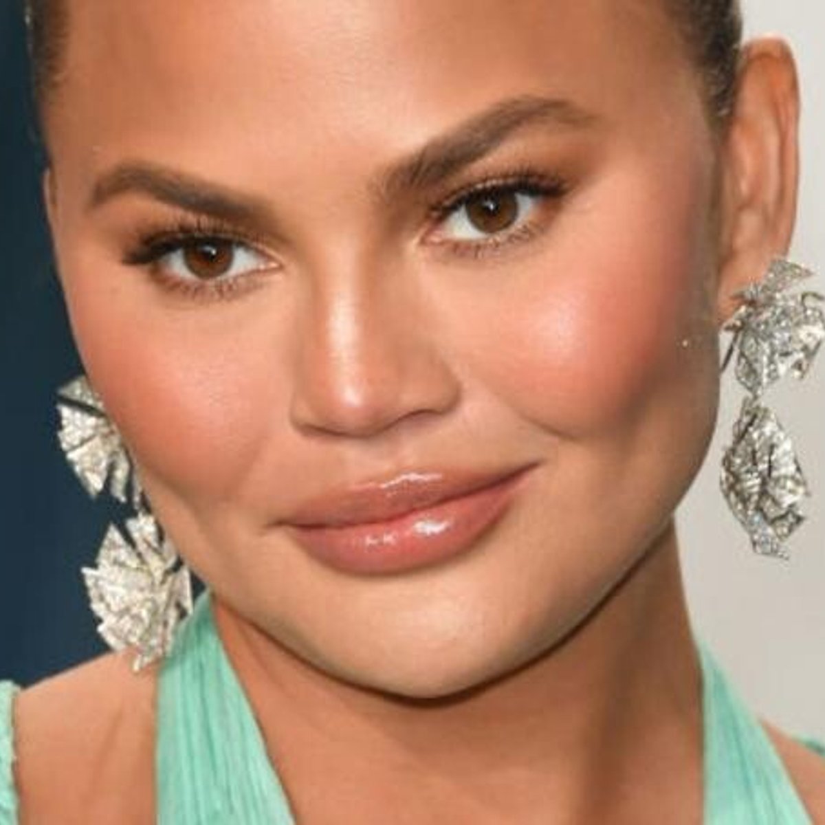 フランスで眉の植毛がトレンドに？ その方法や費用は？