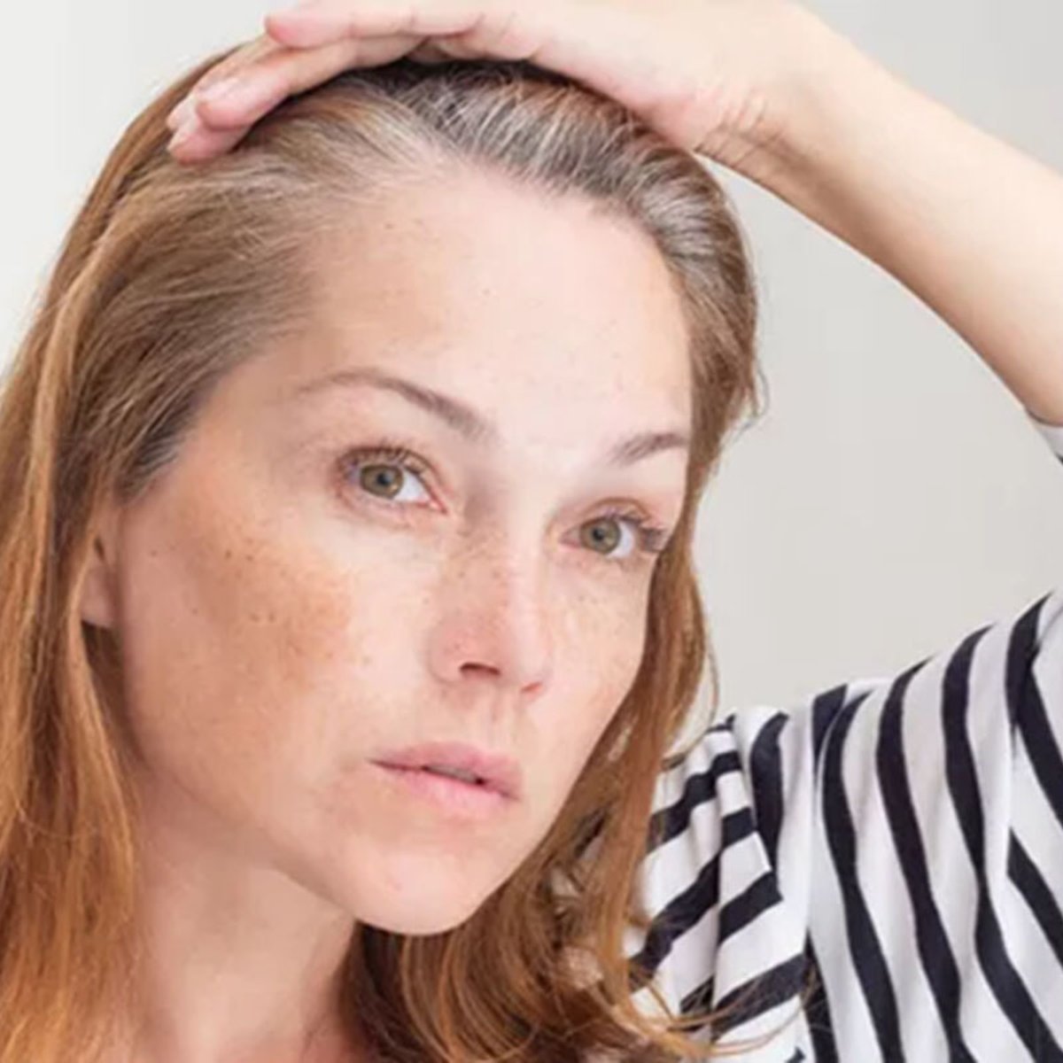 もうすぐ白髪が防げるようになる？