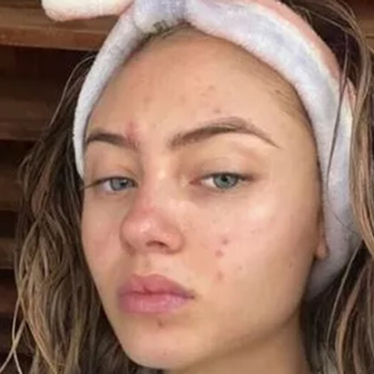 ハイディ・クルムの愛娘レニ、インスタでニキビのある顔を公開。