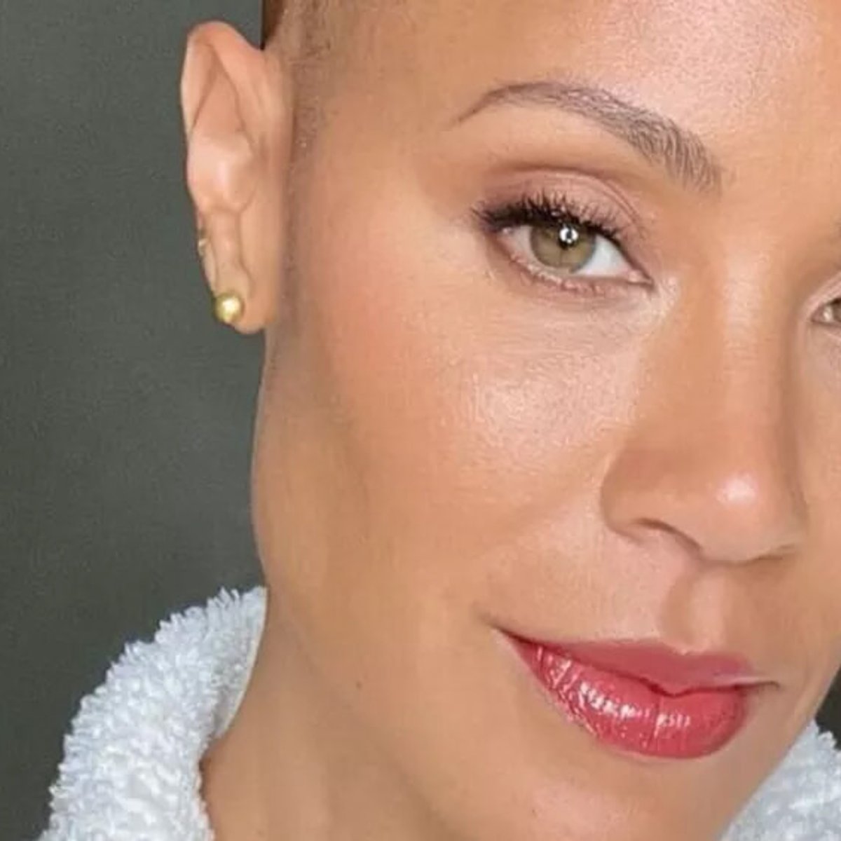 ウィル・スミスの妻、脱毛症のビフォーアフターを公開！