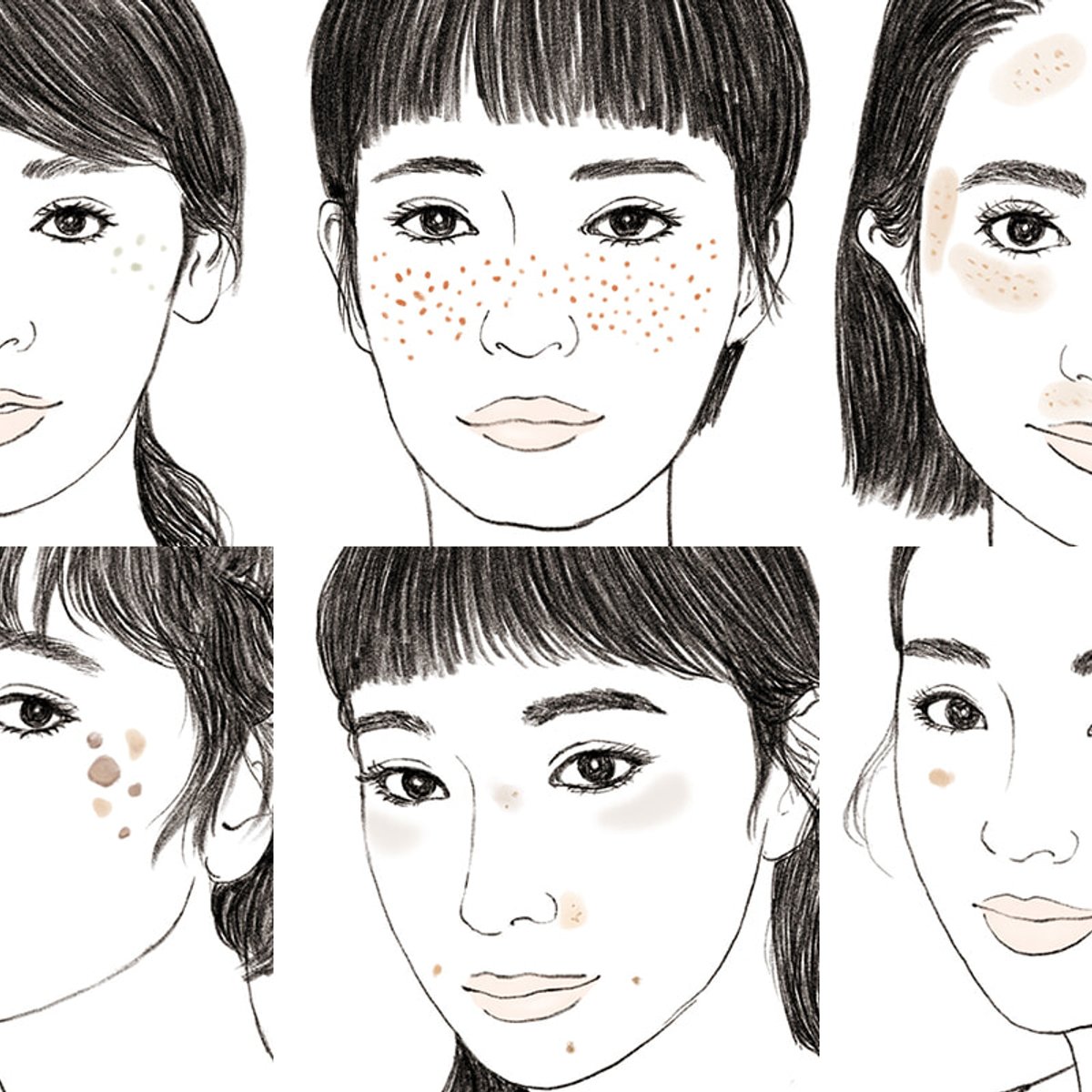 気になるシミは、信頼できるクリニックでまず治療。