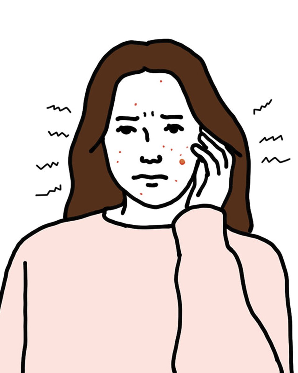 フランス旅行から帰国後なぜかニキビが爆誕。スキンケア、何を使えばいいですか？【さや姉の美容お悩み相談室。vol.20】